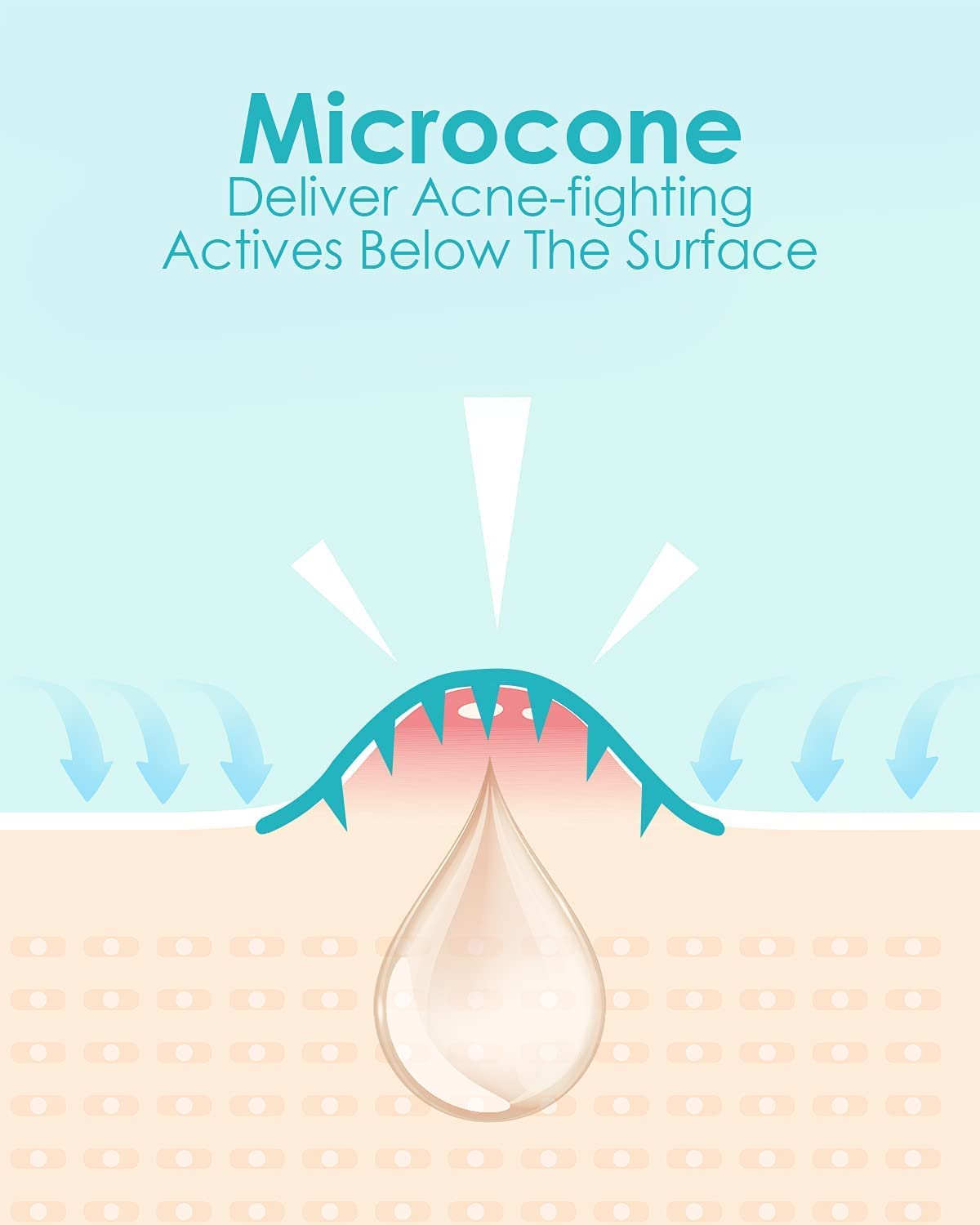+1HEROLABS Microdart Acne Patch (36 Patches) - Hyaluronate Acid & Salicylic Acid Hydrocolloid Pimple Patch for Deep, Early and Hidden Blemishes (36 Count (Pack of 1))