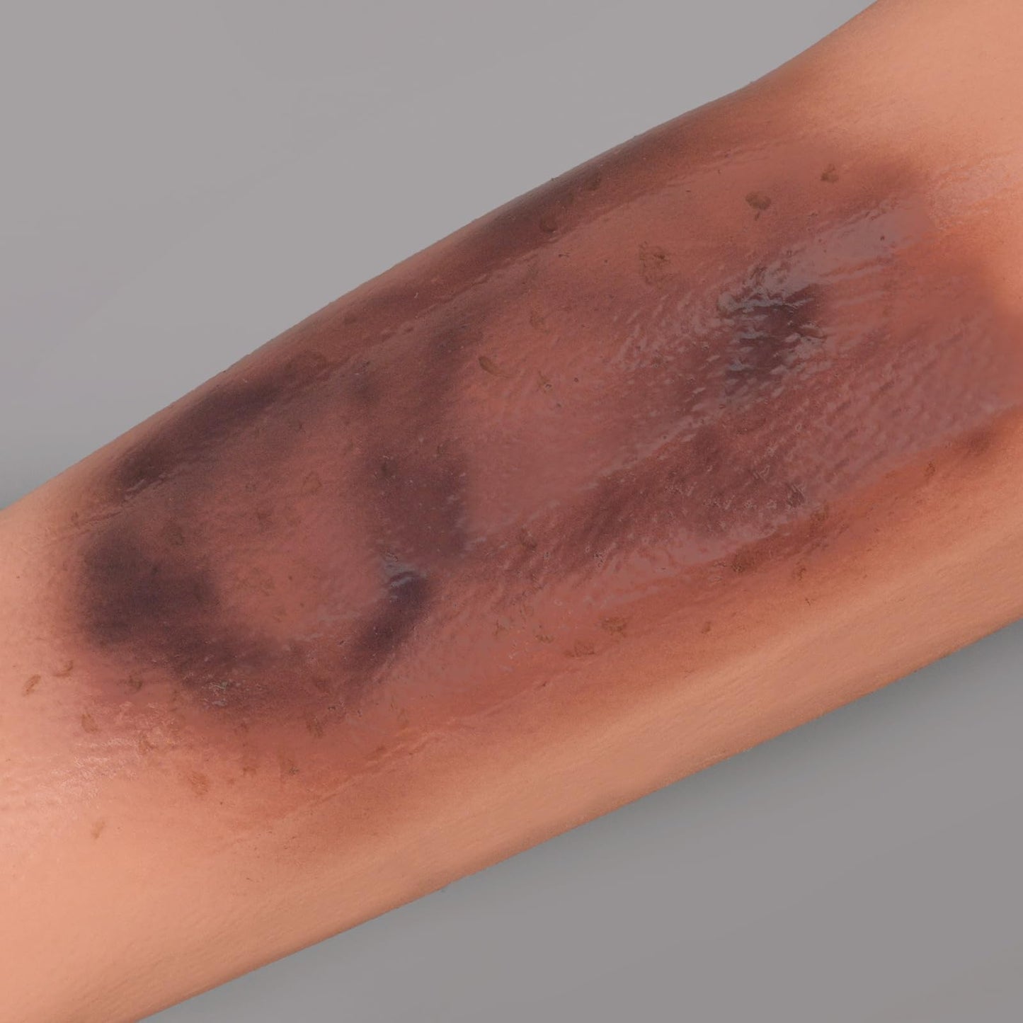 MedEduQuest Bruise Wound Care Training Sleeve, Wound Packing Trainer for Medical Education