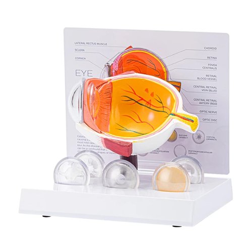 HANGELI Human Anatomical Eye Model Pathological Eyeball Anatomy Model for Clinical Setting Teaching Demonstration Lecture Report