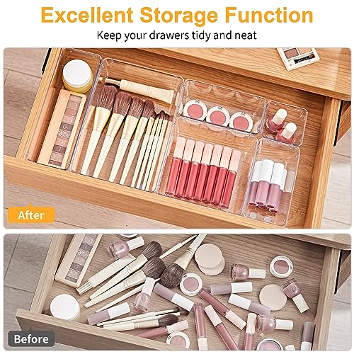 SMARTAKE 13-Piece Clear Drawer Organizer Set with Non-Slip Silicone Pads - 5 Sizes, Includes Variation 13 PCS / Clear