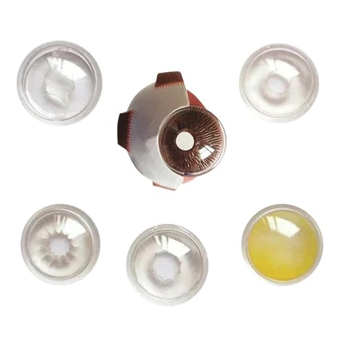 HANGELI Human Anatomical Eye Model Pathological Eyeball Anatomy Model for Clinical Setting Teaching Demonstration Lecture Report