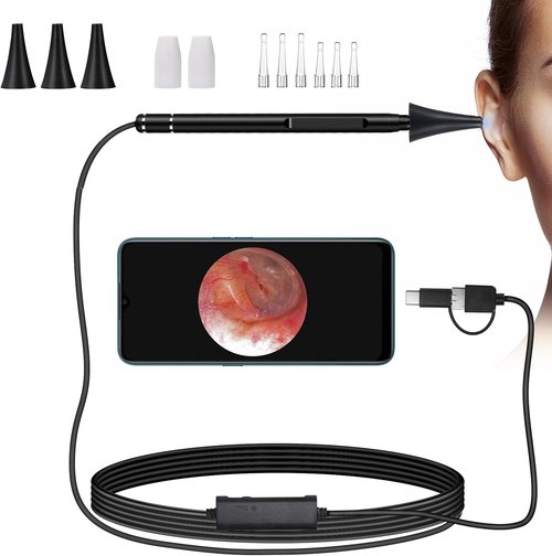 Jiusion 3.9mm Ultra-Thin USB Digital Otoscope Camera - HD 720P Visual Ear Scope with Accessories