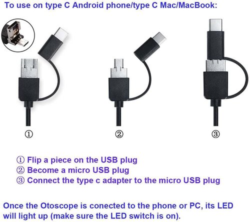 Jiusion 3.9mm Ultra-Thin USB Digital Otoscope Camera - HD 720P Visual Ear Scope with Accessories