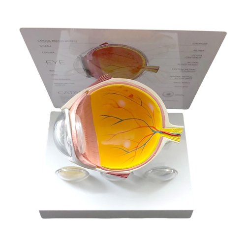 HANGELI Human Anatomical Eye Model Pathological Eyeball Anatomy Model for Clinical Setting Teaching Demonstration Lecture Report