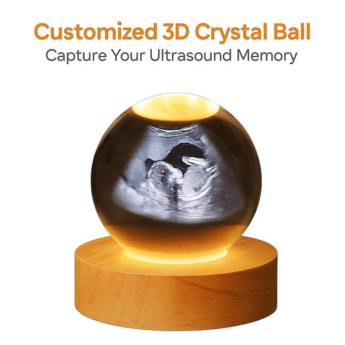 Bumpandlove Magic Sphere, Custom 3D Crystal Ball Ultrasound Digital Display, 3D Ultrasound Globe Esfera Personalizada Con Foto Y Luz, New Mom and Dad Gift