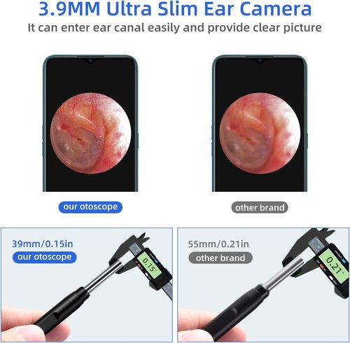 Jiusion 3.9mm Ultra-Thin USB Digital Otoscope Camera - HD 720P Visual Ear Scope with Accessories