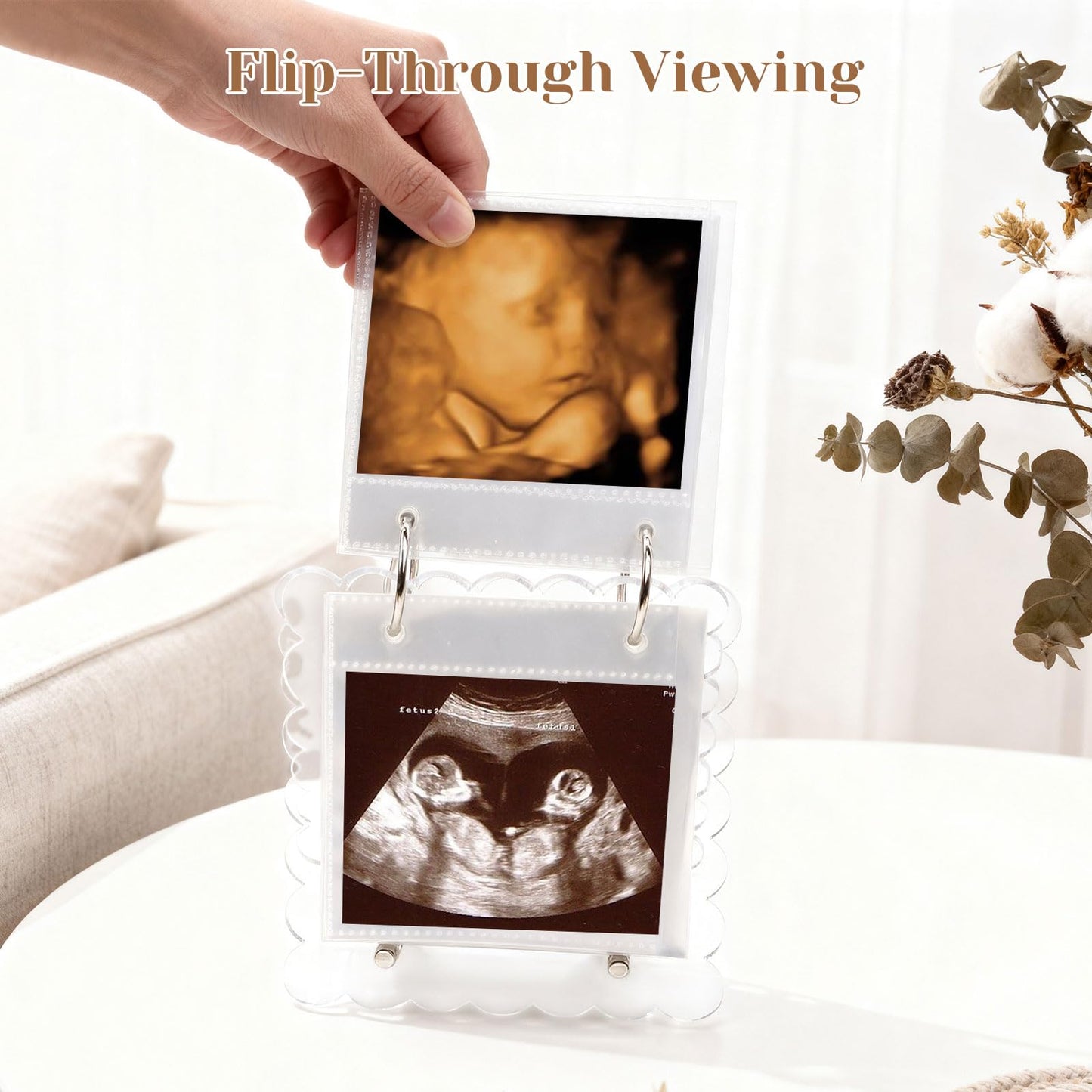 Flip Ultrasound Photo Album with Stand, Refillable Flip-Through Display for 3x4 Pictures, Acrylic Scalloped Cover, Pregnancy Gift for New Parents (Small)