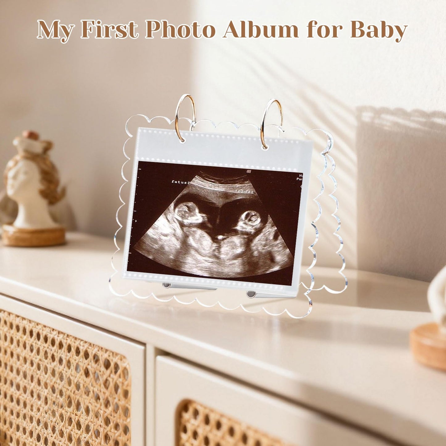 Flip Ultrasound Photo Album with Stand, Refillable Flip-Through Display for 3x4 Pictures, Acrylic Scalloped Cover, Pregnancy Gift for New Parents (Small)