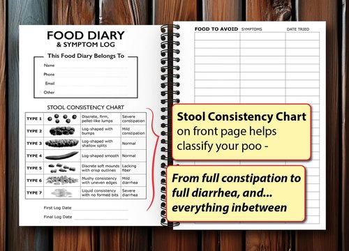 Food Diary and Symptom Log - Track How Your Diet Affects Your Symptoms | for IBS, Allergies, Intolerance, Crohn’s/IBD | A5 (5.8” x 8.3”) Spiral Bound