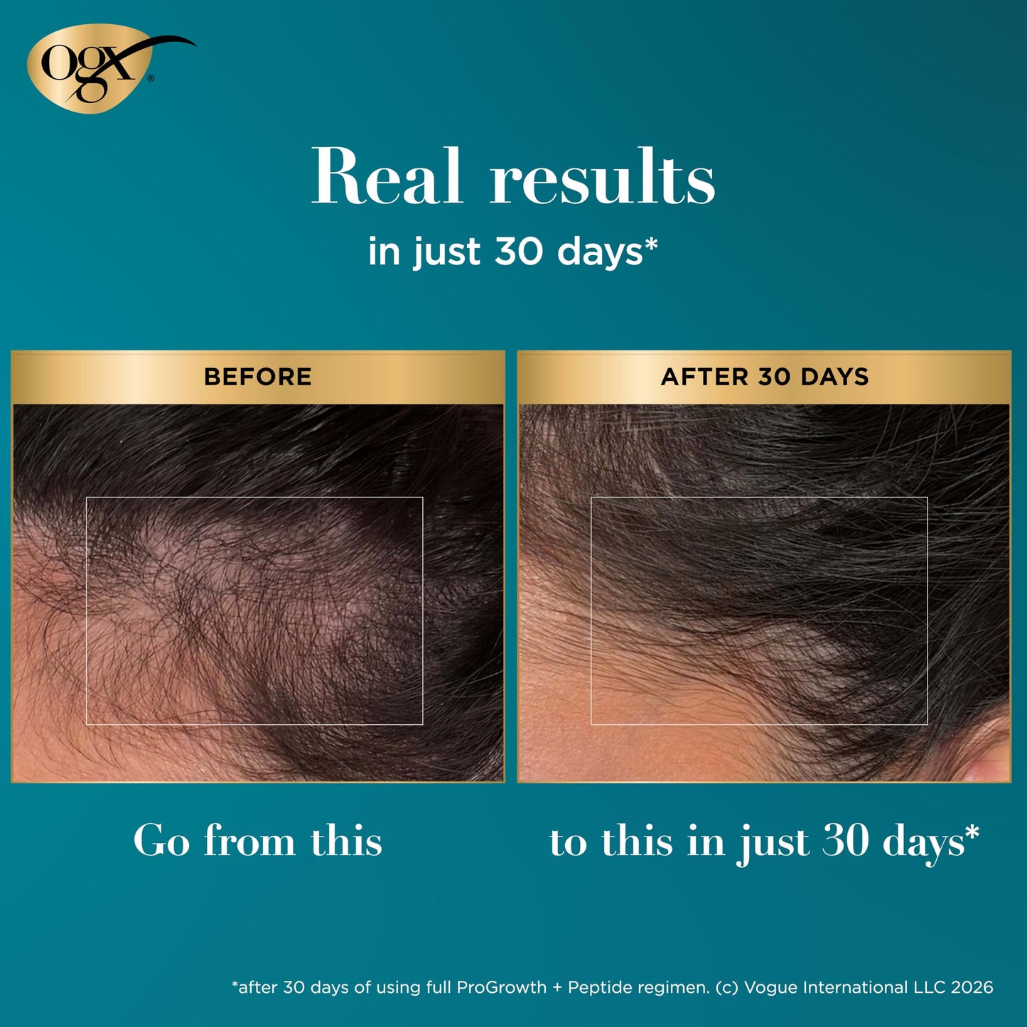 OGX ProGrowth + Peptide Scalp Serum, Hair Serum, 0.33 Fl Oz