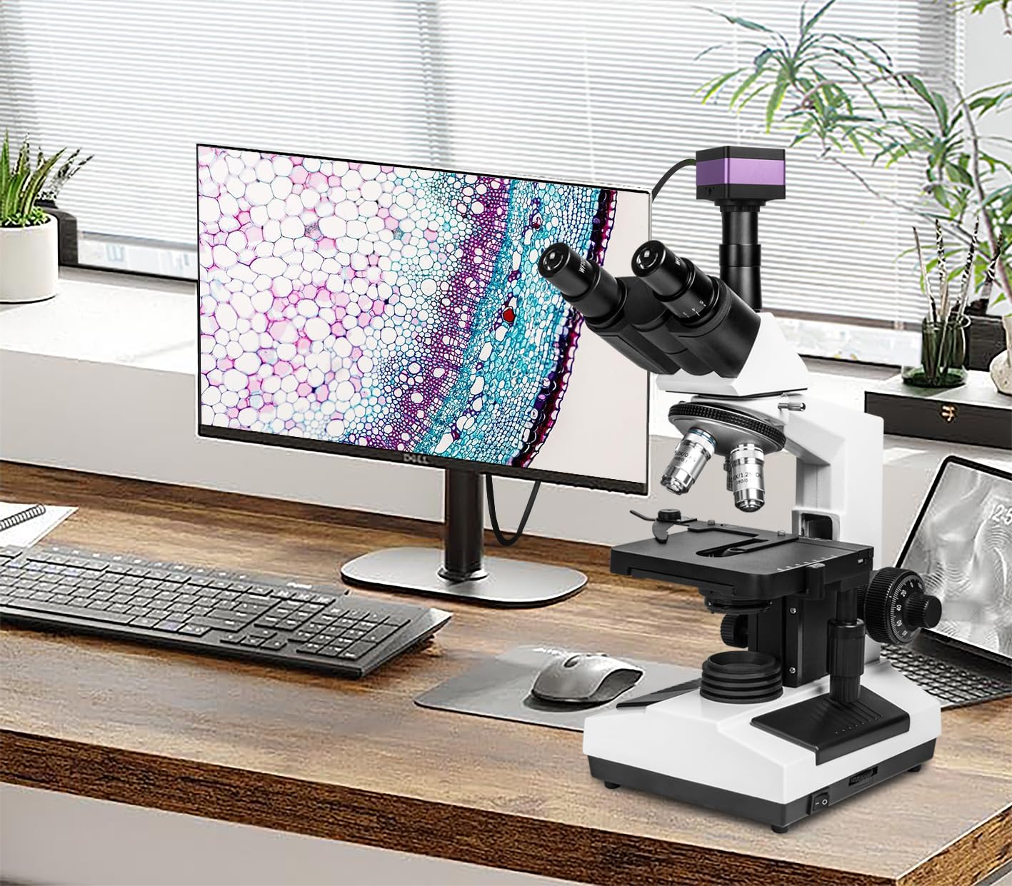 Chaovveion 4K HD Microscope Camera with Real-Time Imaging – 4608 x 3456 Resolution, 16MP USB Digital Camera for Still Photos and Live Video Capture